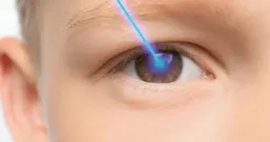 متى يتوقف الاستجماتيزم