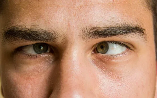 عمليات تصحيح الحول للكبار