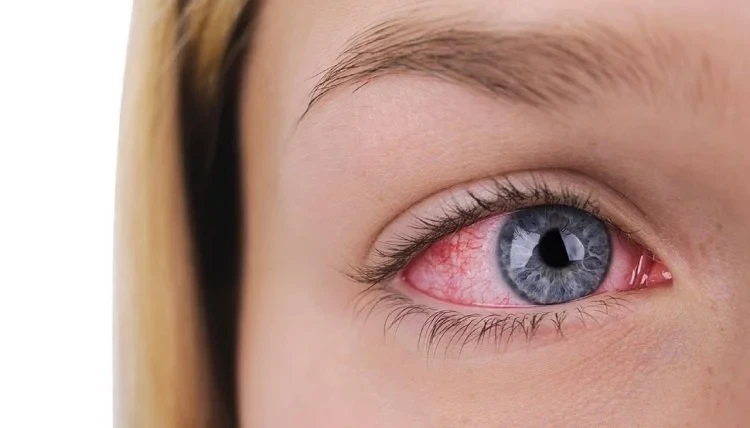 علامات فشل عملية المياه البيضاء