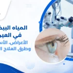 صورة توضيحية تُظهر عيناً سليمة وأخرى مصابة بالمياه البيضاء في العين، مع شرح بسيط لموقع العدسة واعتامها