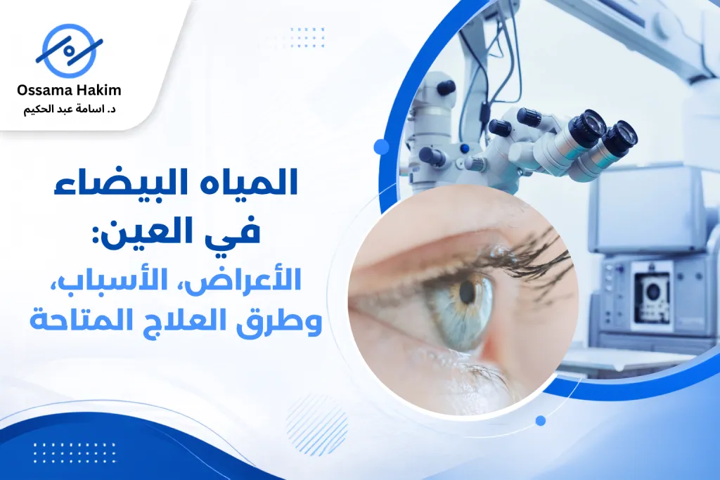 صورة توضيحية تُظهر عيناً سليمة وأخرى مصابة بالمياه البيضاء في العين، مع شرح بسيط لموقع العدسة واعتامها