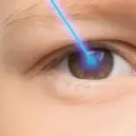 متى يتوقف الاستجماتيزم