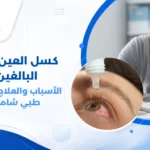 طبيب عيون يفحص عين مريض بالغ باستخدام مجهر إلكتروني، مع رسم تخطيطي يوضح الفرق بين العين السليمة والعين الكسولة وكيفية تأثيرها على الدماغ والرؤية