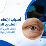 رسم توضيحي يوضح أسباب ارتخاء الجفن العلوي للعين، مع مقارنة بين الجفن الطبيعي والجفن المتدلي، وإظهار مستوى الجفن بالنسبة لحدقة العين ومجال الرؤية