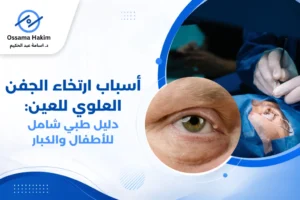رسم توضيحي يوضح أسباب ارتخاء الجفن العلوي للعين، مع مقارنة بين الجفن الطبيعي والجفن المتدلي، وإظهار مستوى الجفن بالنسبة لحدقة العين ومجال الرؤية