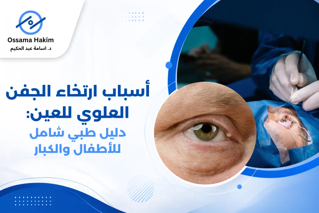 رسم توضيحي يوضح أسباب ارتخاء الجفن العلوي للعين، مع مقارنة بين الجفن الطبيعي والجفن المتدلي، وإظهار مستوى الجفن بالنسبة لحدقة العين ومجال الرؤية