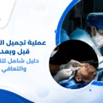 صورة توضيحية ل عملية تجميل الجفون قبل وبعد تظهر الفرق في مظهر العينين والجفنين بعد الجراحة