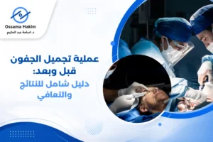 صورة توضيحية ل عملية تجميل الجفون قبل وبعد تظهر الفرق في مظهر العينين والجفنين بعد الجراحة