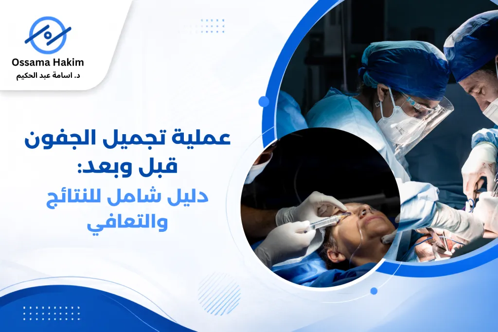 صورة توضيحية ل عملية تجميل الجفون قبل وبعد تظهر الفرق في مظهر العينين والجفنين بعد الجراحة