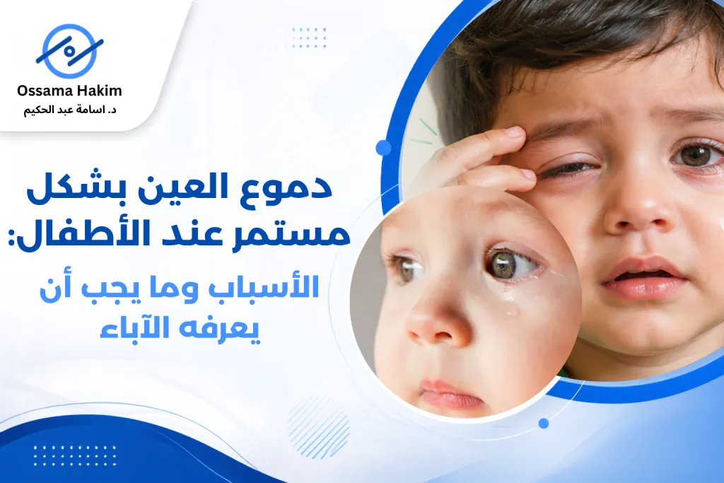 طفل صغير تظهر عينه دامعة باستمرار، توضيح لحالة دموع العين المستمرة عند الأطفال