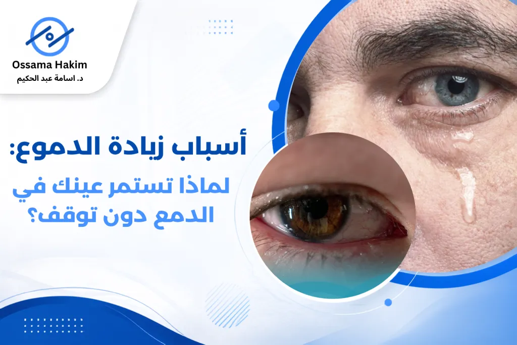 عين تدمع مع توضيح القناة الدمعية وأسباب زيادة الدموع