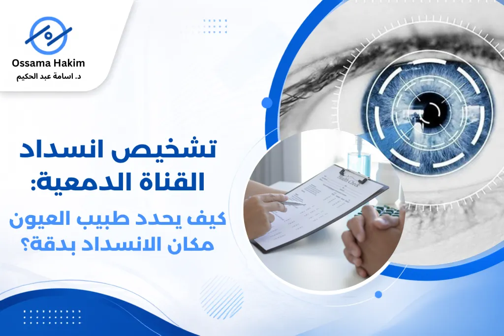 طبيب عيون يفحص عين مريض لتشخيص انسداد القناة الدمعية باستخدام اختبار غسل القناة الدمعية