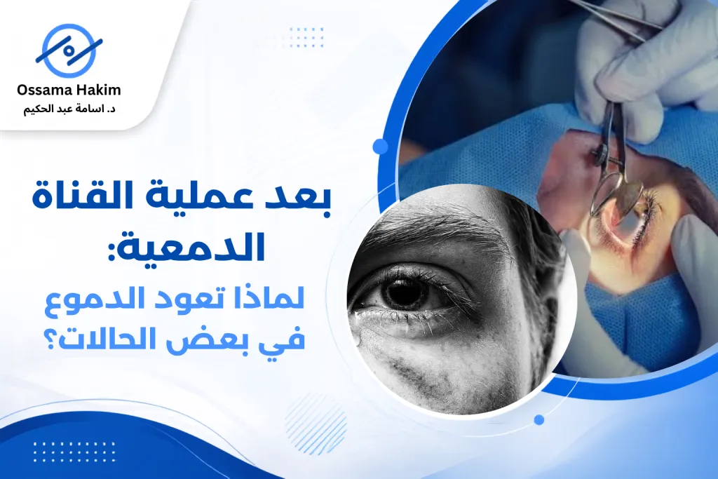مريض يستشير طبيب عيون بعد عملية القناة الدمعية لمناقشة استمرار الدمعان