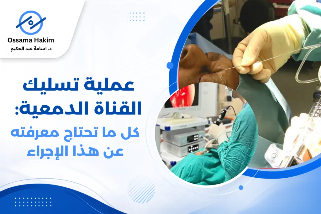 رسم توضيحي لعملية تسليك القناة الدمعية يوضح مسار الدموع من العين إلى الأنف