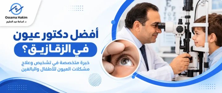 أفضل دكتور عيون في الزقازيق؟