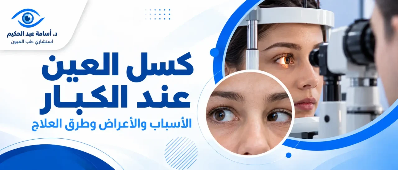 كسل العين عند الكبار